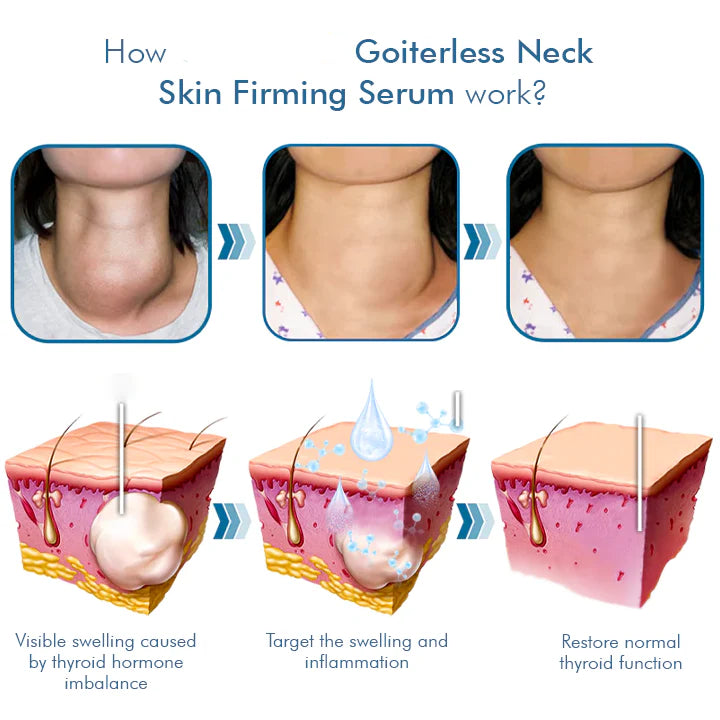 Goiterless Neck Skin Firming Serum