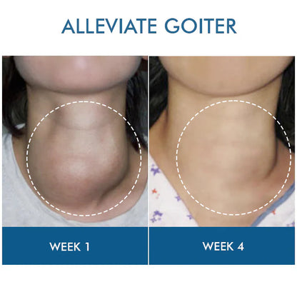 Goiterless Neck Skin Firming Serum